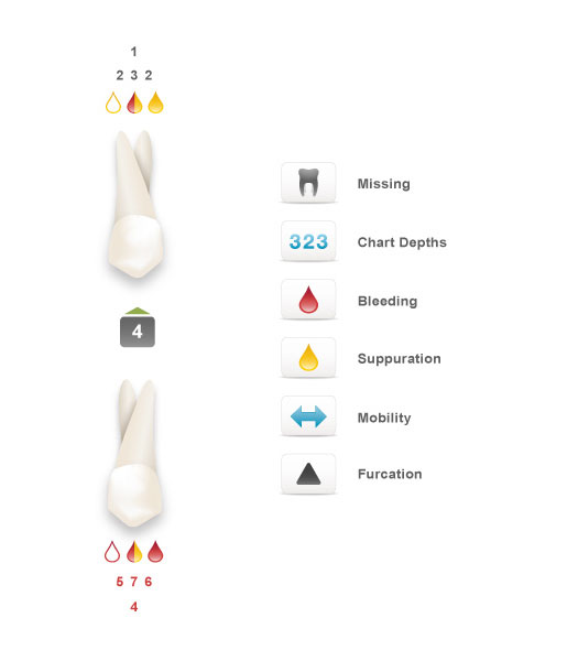 Smile Brands Periodontal Illustrations by Ripcord Digital Inc.